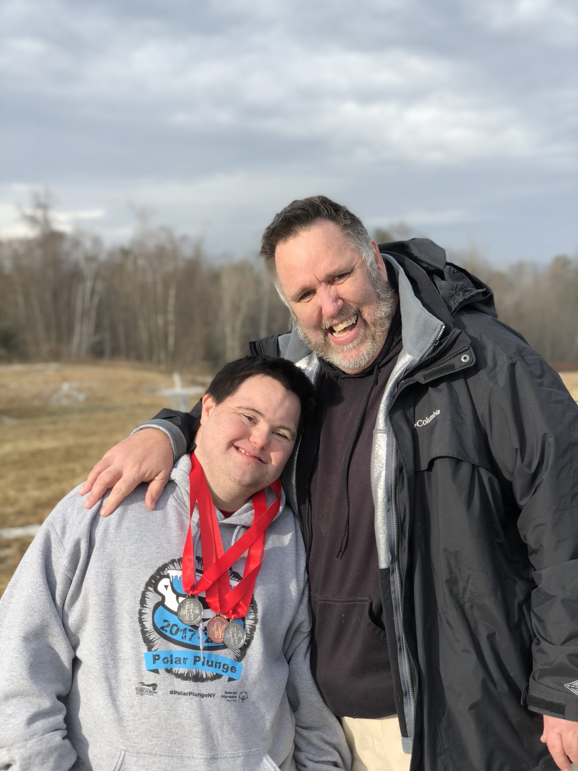 Alzheimer’s and Down Syndrome: A Crisis We Can’t Ignore